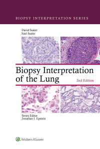 Cover image: Biopsy Interpretation of the Lung 2nd edition 9781975136581