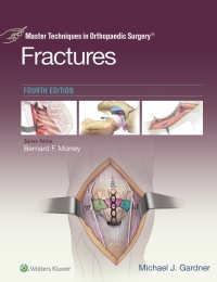Imagen de portada: Master Techniques in Orthopaedic Surgery: Fractures 4th edition 9781975139407