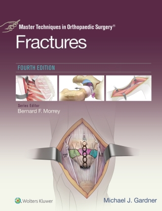 Cover image: Master Techniques in Orthopaedic Surgery: Fractures 4th edition 9781975139407