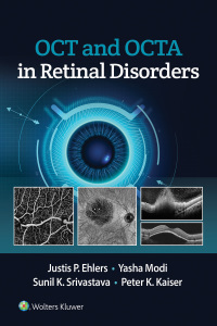 Titelbild: OCT and OCT Angiography in Retinal Disorders 9781975144227