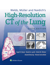 Cover image: Webb, Müller and Naidich's High-Resolution CT of the Lung 6th edition 9781975144432