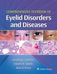 Cover image: Comprehensive Textbook of Eyelid Disorders and Diseases 1st edition 9781975146146