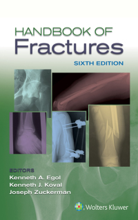 Cover image: Handbook of Fractures 6th edition 9781496384850
