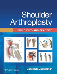 Cover image: Shoulder Arthroplasty 9781975157661