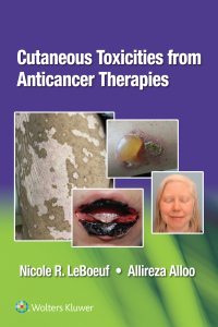 Omslagafbeelding: Cutaneous Reactions from Anti-Cancer Therapies 1st edition 9781975157890