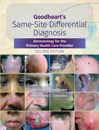Cover image: Goodheart's Same-Site Differential Diagnosis 9781975161330