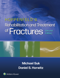Cover image: Hoppenfeld's Treatment and Rehabilitation of Fractures 2nd edition 9781451185683
