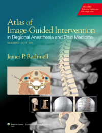 Omslagafbeelding: Atlas of Image-Guided Intervention in Regional Anesthesia and Pain Medicine 2nd edition 9781608317042