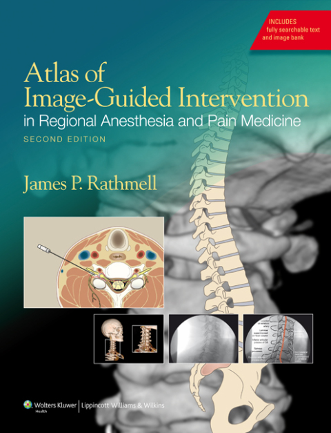 Atlas of Image-Guided Intervention in Regional Anesthesia and Pain Medicine, 2nd Edition - FULL INSTANT DOWNLOAD | PDF DOCX EPUB