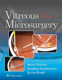 Titelbild: Vitreous Microsurgery 6th edition 9781975168353