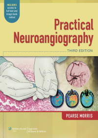 صورة الغلاف: Practical Neuroangiography 3rd edition 9781451144154