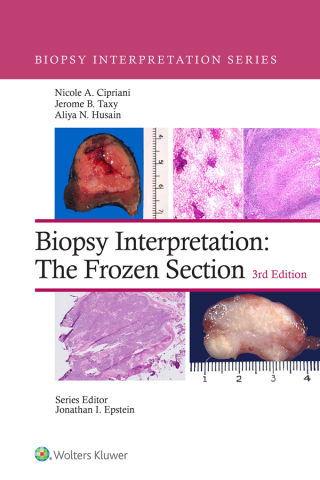 Cover image: Biopsy Interpretation: The Frozen Section 3rd edition 9781975170073