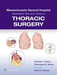 Cover image: Massachusetts General Hospital Illustrated Tips and Tricks in Thoracic Surgery 1st edition 9781975171933