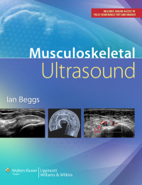 Imagen de portada: Musculoskeletal Ultrasound 1st edition 9781451144987