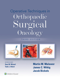 Cover image: Operative Techniques in Orthopaedic Surgical Oncology 3rd edition 9781975172084