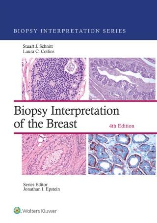 Cover image: Biopsy Interpretation of the Breast 4th edition 9781975183929
