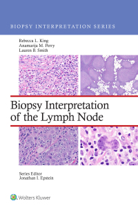 Cover image: Biopsy Interpretation of the Lymph Nodes 1st edition 9781975184629