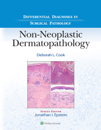صورة الغلاف: Differential Diagnoses in Surgical Pathology: Non-Neoplastic Dermatopathology 1st edition 9781975184650
