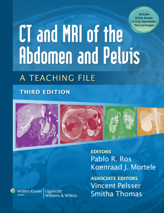 Titelbild: CT & MRI of the Abdomen and Pelvis 3rd edition 9781451113525