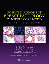 Imagen de portada: Rosen's Diagnosis of Breast Pathology by Needle Core Biopsy 5th edition 9781975198367