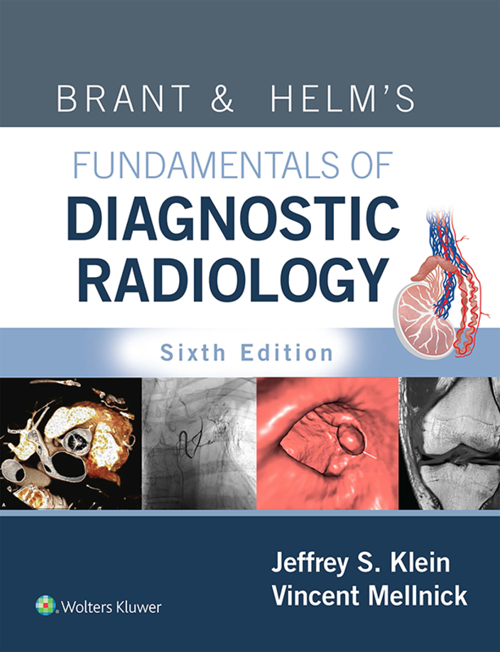 Brant & Helm’s Fundamentals of Diagnostic Radiology 6th Edition