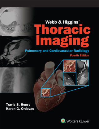Cover image: Webb & Higgins Thoracic Imaging: eBook with Multimedia 4th edition 9781975199388