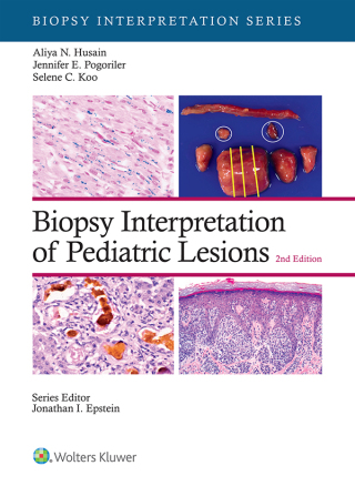 Cover image: Biopsy Interpretation of Pediatric Lesions 2nd edition 9781975213268
