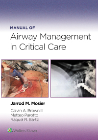 Imagen de portada: Manual of Airway Management in Critical Care 1st edition 9781975214203