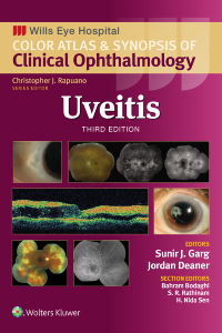 Cover image: Uveitis 3rd edition 9781975215194