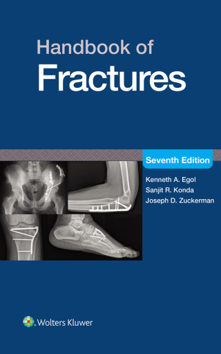 Cover image: Handbook of Fractures 7th edition 9781975217990