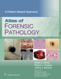表紙画像: Atlas of Forensic Pathology: A Pattern Based Approach 1st edition 9781975222505