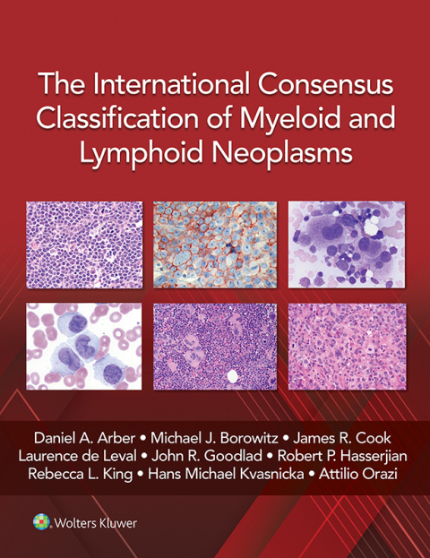 The International Consensus Classification of Myeloid and Lymphoid Neoplasms - FULL INSTANT DOWNLOAD | PDF DOCX EPUB