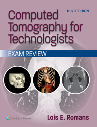 Cover image: Computed Tomography for Technologists: Exam Review 3rd edition 9781975232993