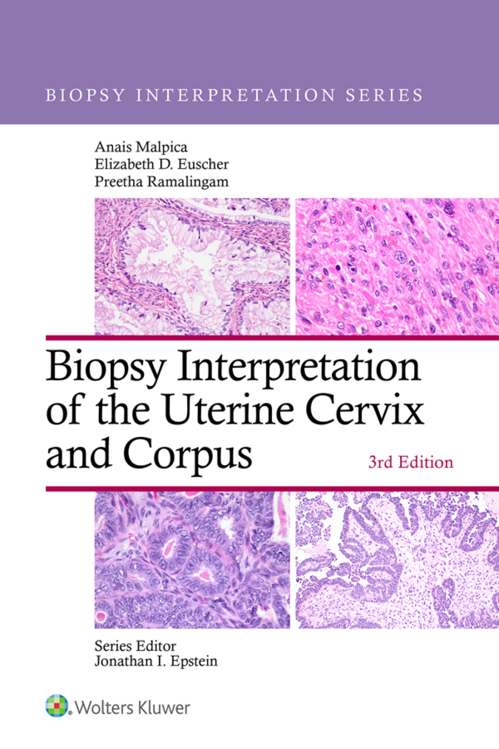 ISBN 9781975236786 product image for Biopsy Interpretation of the Uterine Cervix and Corpus - 3rd Edition (eBook) | upcitemdb.com