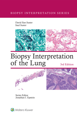 Cover image: Biopsy Interpretation of the Lung 3rd edition 9781975240677