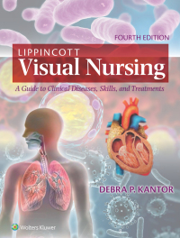 Cover image: Lippincott Visual Nursing 4th edition 9781975222154