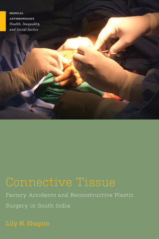 Cover image: Connective Tissue 9781978841536