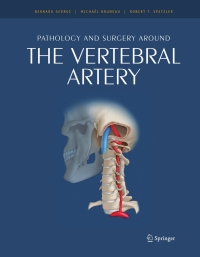 Cover image: Pathology and surgery around the vertebral artery 1st edition 9782287897863