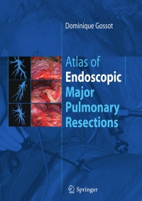 Immagine di copertina: Atlas of endoscopic major pulmonary resections 9782287997761