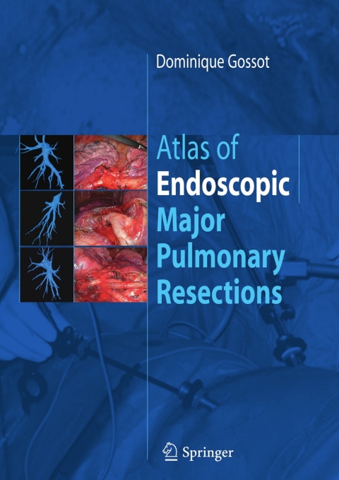 Atlas of endoscopic major pulmonary resections - FULL INSTANT DOWNLOAD | PDF DOCX EPUB