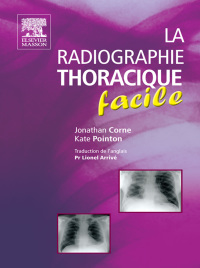 صورة الغلاف: La radiographie thoracique facile 9782294711015