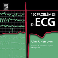 Omslagafbeelding: 150 problèmes d'ECG 3rd edition 9782810101498