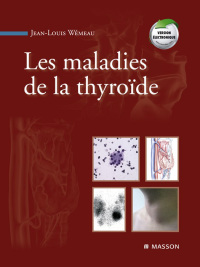 Immagine di copertina: Les maladies de la thyroïde 9782294074646