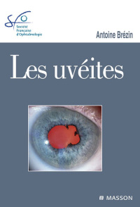 Immagine di copertina: Les uvéites 9782294711077