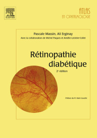 Immagine di copertina: Rétinopathie diabétique 2nd edition 9782294611711
