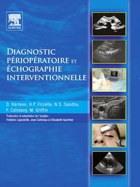 Immagine di copertina: Diagnostic périopératoire et échographie interventionnelle 9782810100880