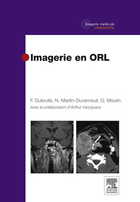 Cover image: Imagerie en ORL 9782294704987