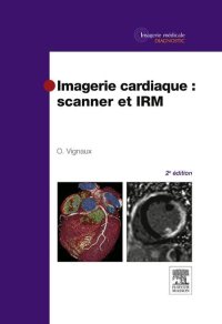 Immagine di copertina: Imagerie cardiaque : scanner et IRM 2nd edition 9782294712258