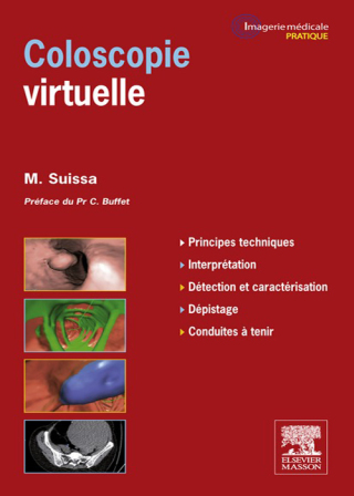 Cover image: Coloscopie virtuelle 9782294710278