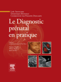 Titelbild: Le Diagnostic prénatal en pratique 9782294709623
